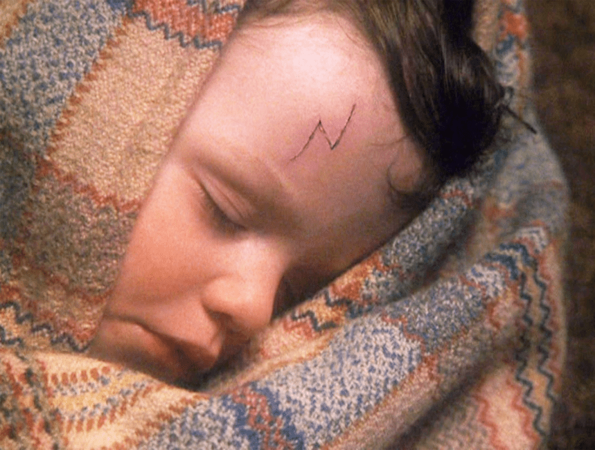 Harry’s scar from killingcurse